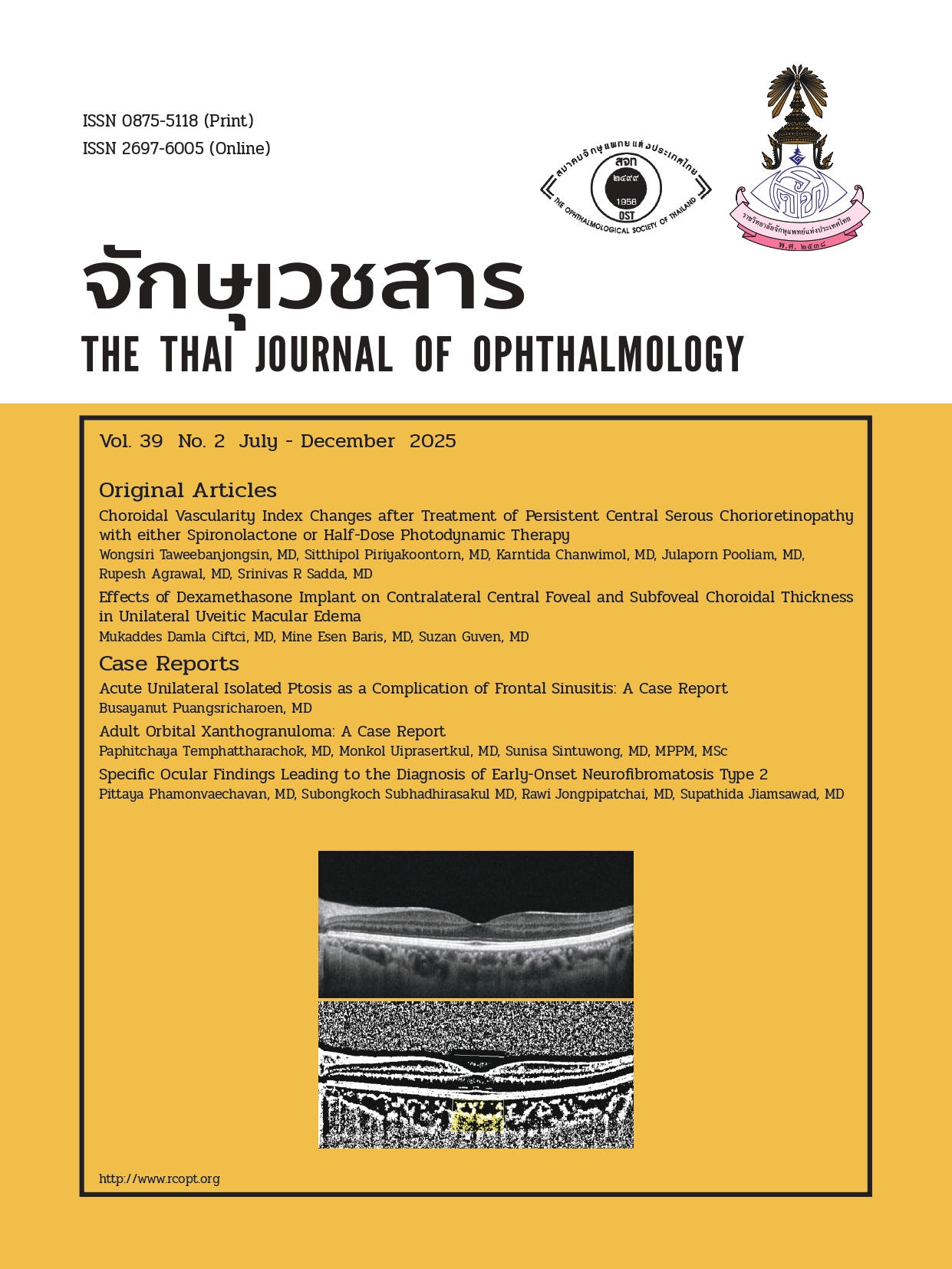 2212Cover J Ophthalmol-39-2-68-E1_page-0001.jpg